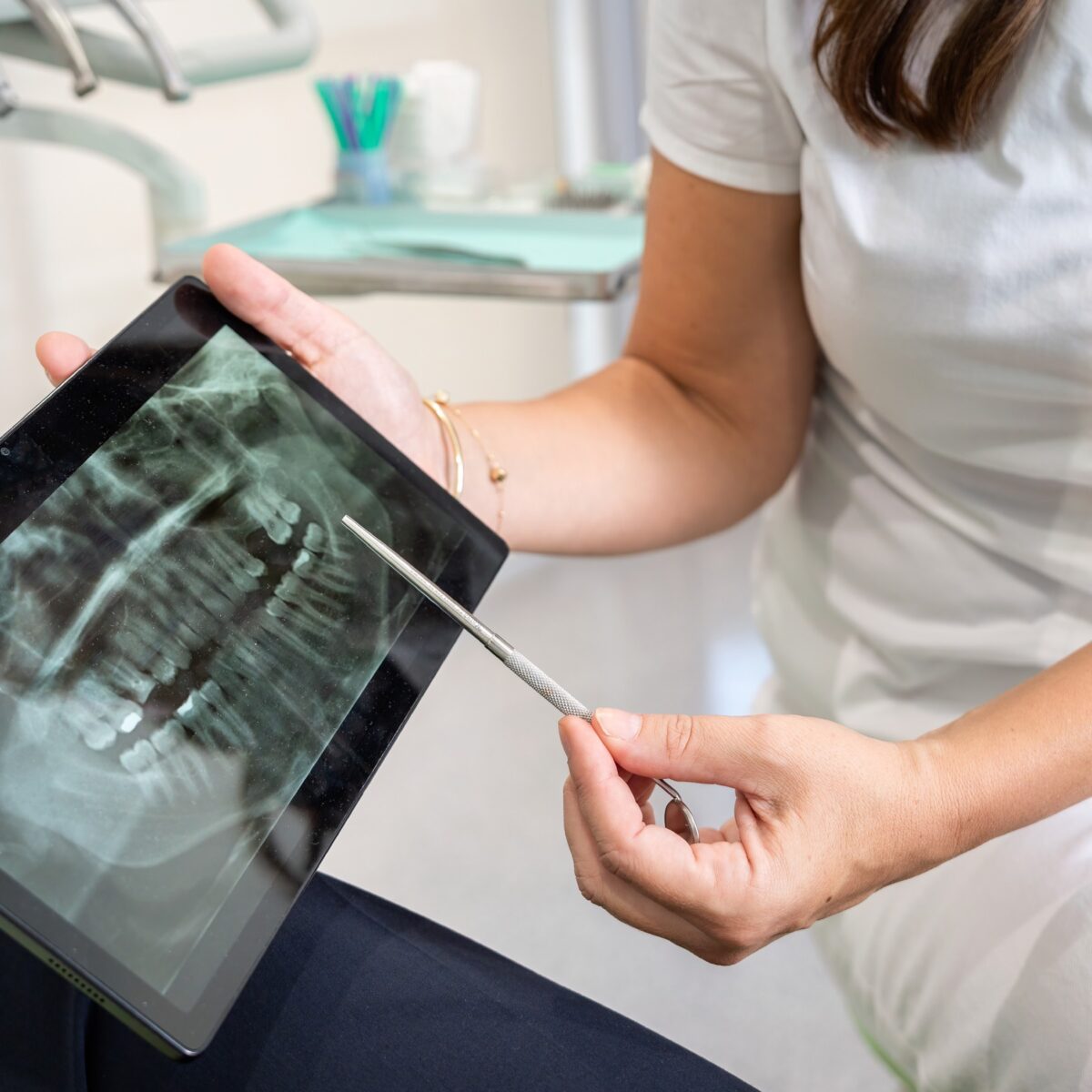 stomatoloski rendgen