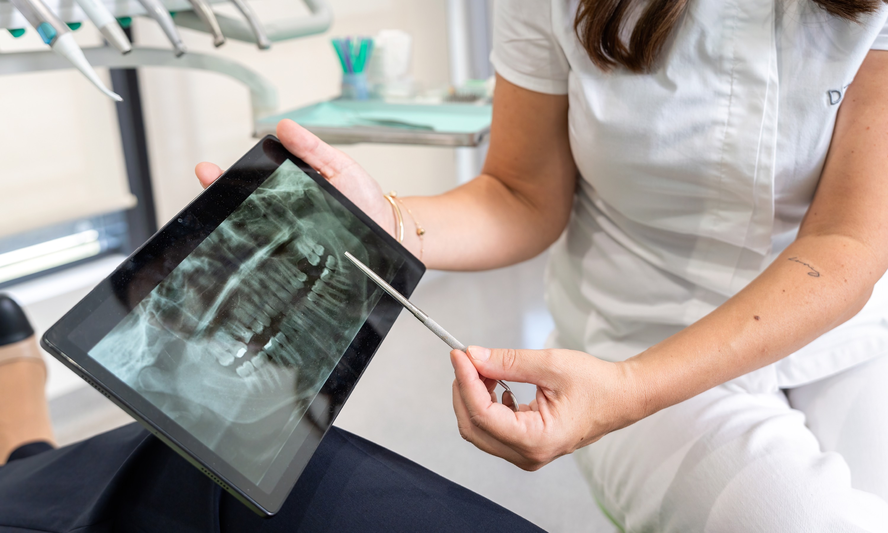 stomatoloski rendgen